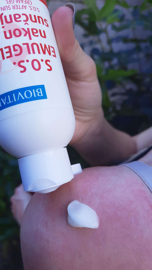 S.O.S. Emulgel nakon sunca