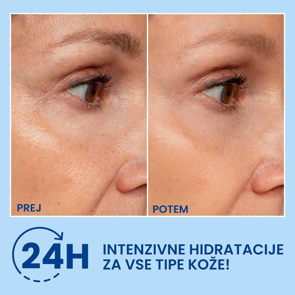 HA filler for face