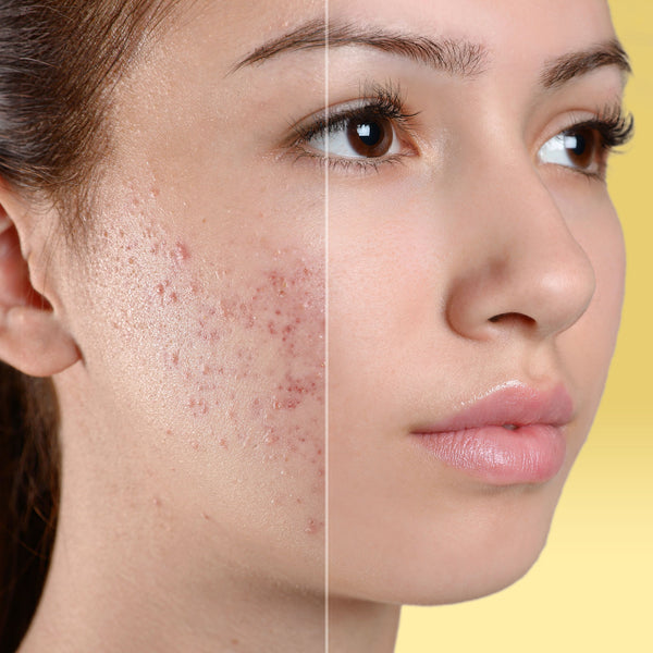 Tratamiento para el Cuidado de la Piel