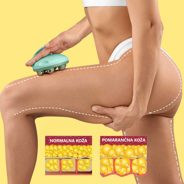 Massaggiatore Anti-Cellulite