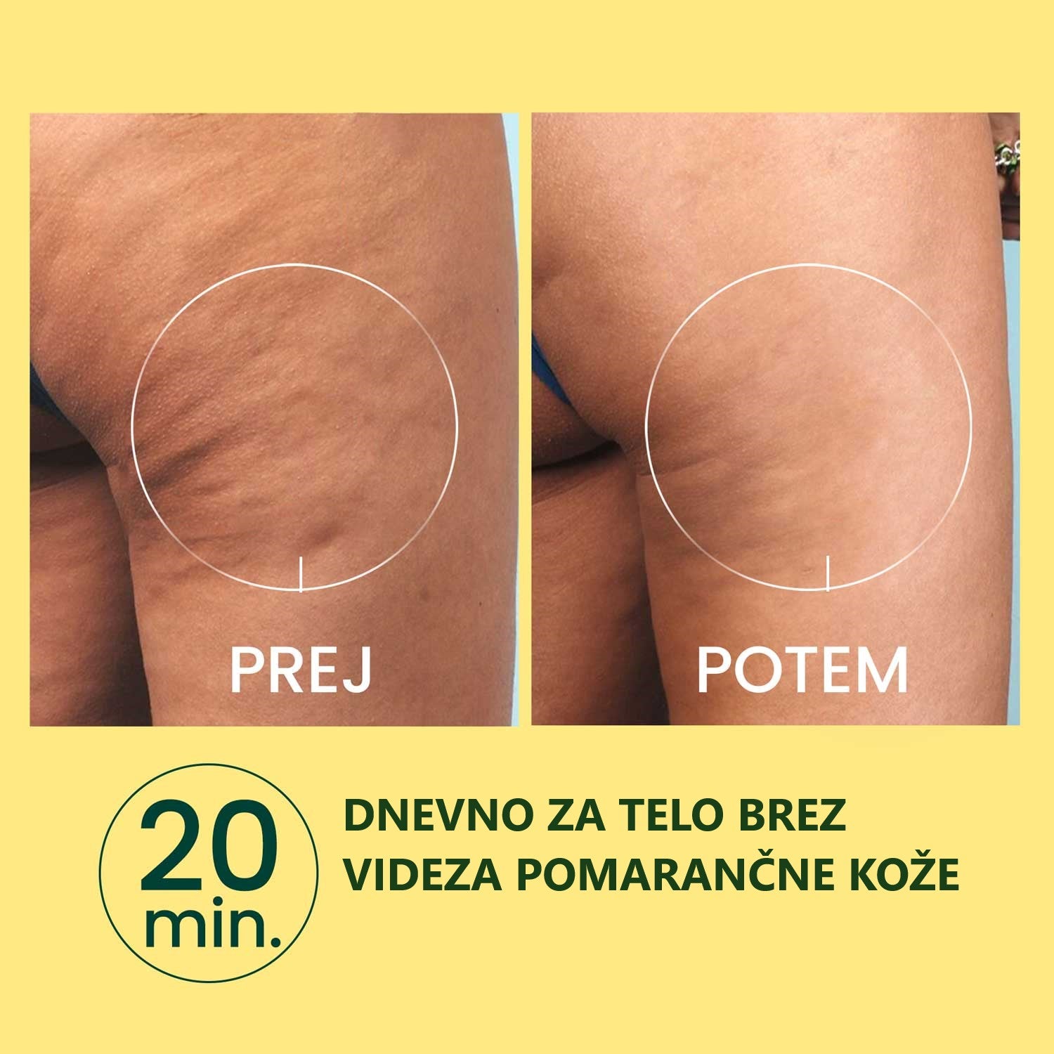 Massaggiatore Anti-Cellulite