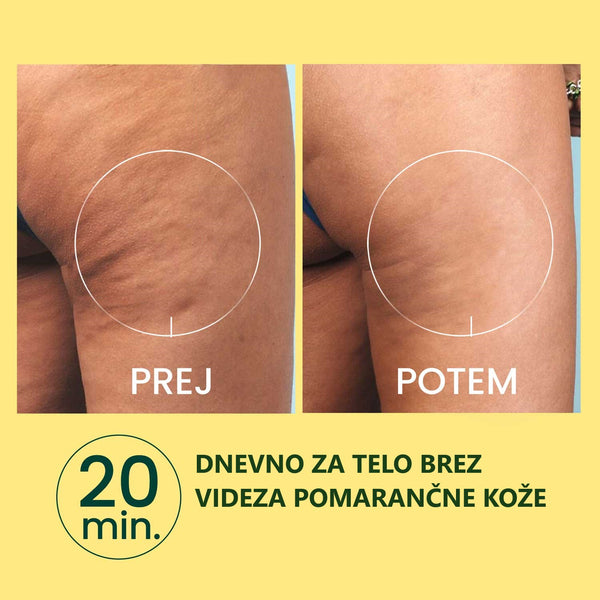 Massaggiatore Anti-Cellulite