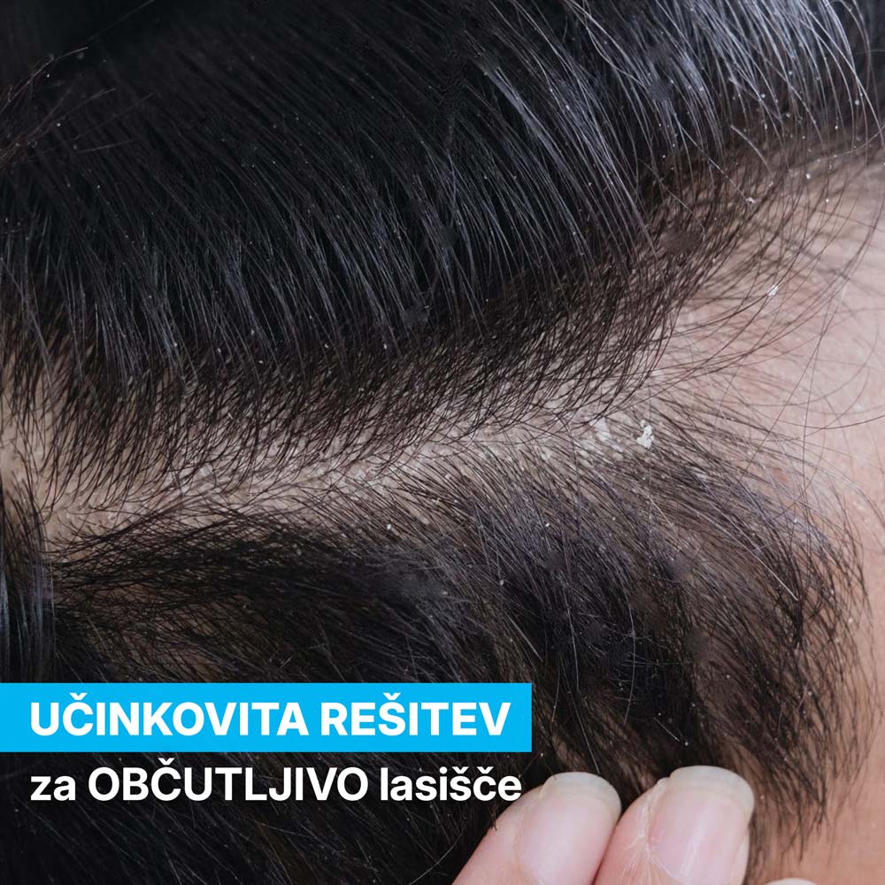 Anti-Dandruff and Scalp Irritation Set