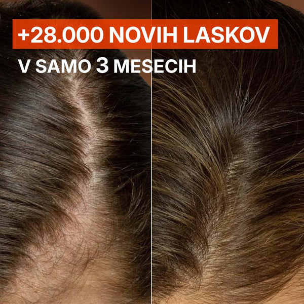 Scalp Ampoule - Fenugreek