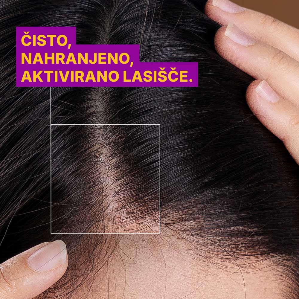 Loción Anti-Grasa