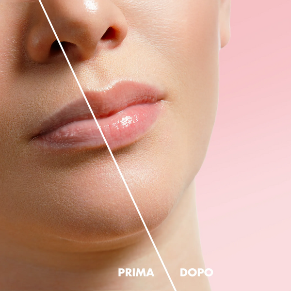 Volumizing Lip Gloss