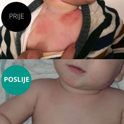 Emulsion for the care of very dry skin prone to atopy