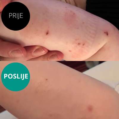 Emulsion for the care of very dry skin prone to atopy