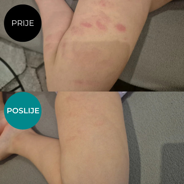 Prije i poslije Emulzija, Fluid