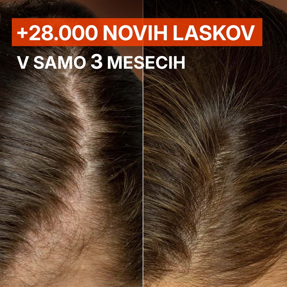 DUO Scalp Ampoule - Fieno greco